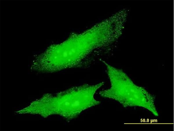 ODC1 / Ornithine Decarboxylase Antibody (clone 2G5)