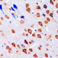 Polyclonal Rabbit anti-Human CHEK1 / CHK1 Antibody (Internal, IHC, IF, WB)