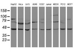 IHC-plus™ SKIL / SNO / SnoN Antibody (clone 2F6)