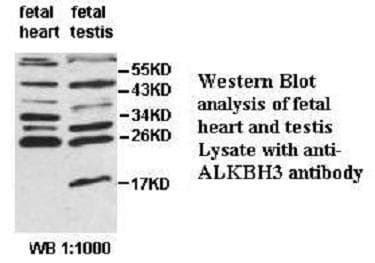 PCA1 / ALKBH3 Antibody (aa2-95)