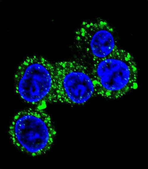Polyclonal Rabbit anti-Human CACNG6 Antibody (aa108-136, IHC, IF, WB)