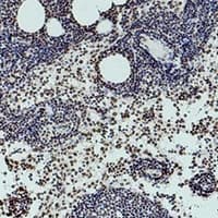 Monoclonal Mouse anti-Human HIST1H3H Antibody (IHC, WB)