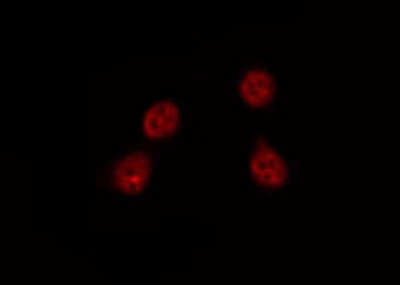 ATXN1 / SCA1 Antibody