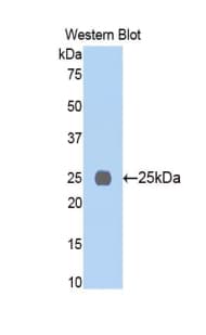 MYHC / MYH6 Antibody (aa1747-1938)