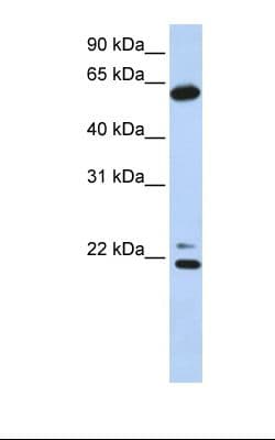 Polyclonal Rabbit anti-Human CCT5 / TCP1 Epsilon Antibody (C-Terminus, IHC, WB)