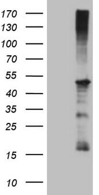REN / Renin 1 Antibody (aa131-406, clone OTI1A10, Carrier-free)