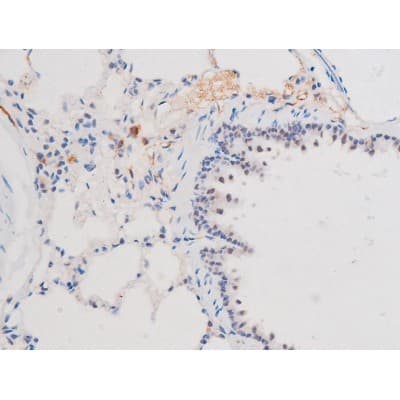 STAT1 Antibody (phospho-Ser727)