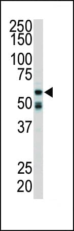 RICK / RIP2 Antibody (aa458-488)