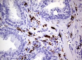 F13A1 / Factor XIIIa Antibody (clone OTI3F6)