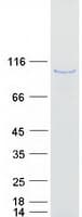 Human AKAP8L Protein (Recombinant Myc-DDK (Flag))