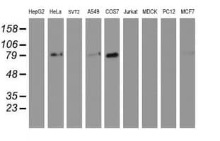 GOLM1 / GP73 / GOLPH2 Antibody (clone 6C9, Carrier-free)
