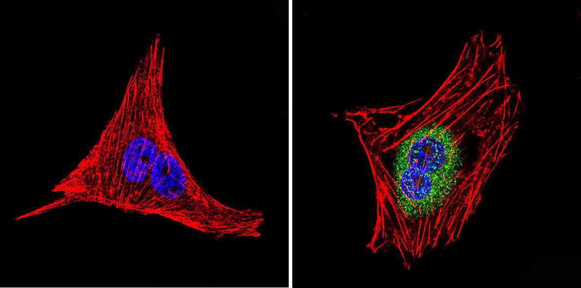 IHC-plus™ Polyclonal Rabbit anti-Human LIN28A / LIN28 Antibody (IHC, IF, WB)