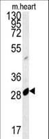 Polyclonal Rabbit anti-Human APOBEC2 Antibody (aa19-48, IHC, WB)