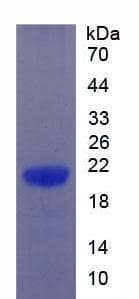 Human IL6ST / CD130 / gp130 Protein (Recombinant His)
