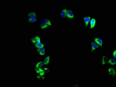 FCER2 / CD23 Antibody (aa48-321)