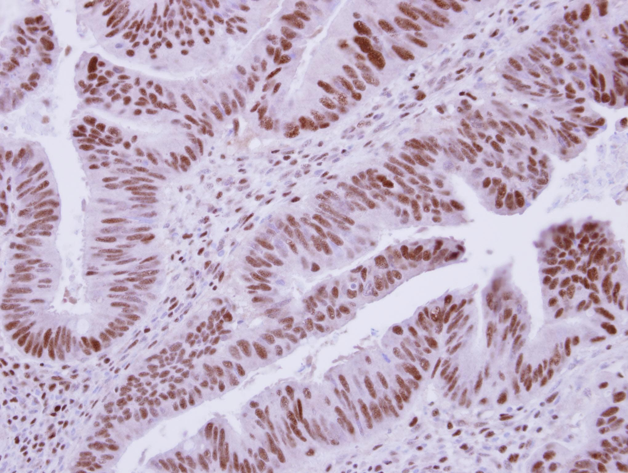 Polyclonal Rabbit anti-Human DCPS Antibody (IHC, WB)