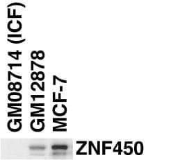 ZBTB24 / BIF1 Antibody (aa137-166)