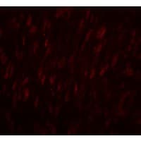 IHC-plus™ Polyclonal Rabbit anti-Human SLC29A1 / ENT1 Antibody (IHC, IF, WB)