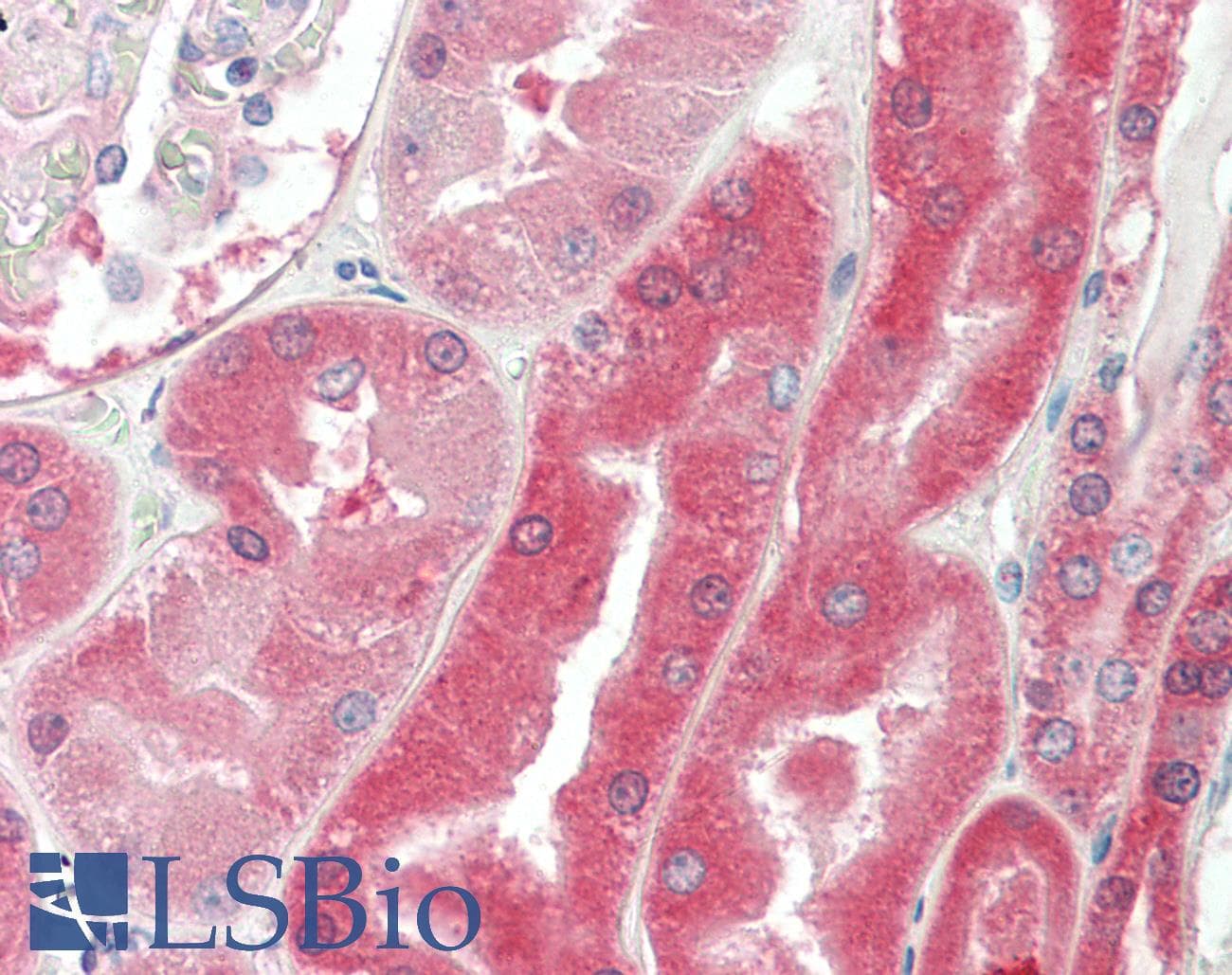 IHC-plus™ Polyclonal Goat anti-Human VHL / Von Hippel Lindau Antibody (aa167-179, IHC, WB)