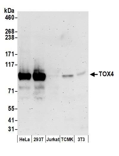TOX4 / C14orf92 Antibody (aa25-75)