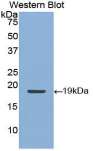 KRT9 / CK9 / Cytokeratin 9 Antibody (aa315-456)