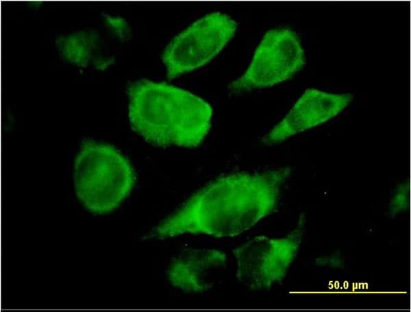 SSR4 Antibody (clone 2D3)