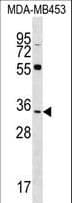 FKBP6 Antibody (aa256-284)