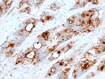 Monoclonal Mouse anti-Human CEA / Carcinoembryonic Antigen Antibody (clone CEA31, Azide-free,BSA-free, IHC, IF, WB)