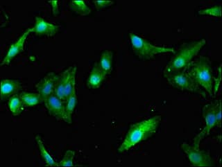 Polyclonal Rabbit anti-Human PAIP2 Antibody