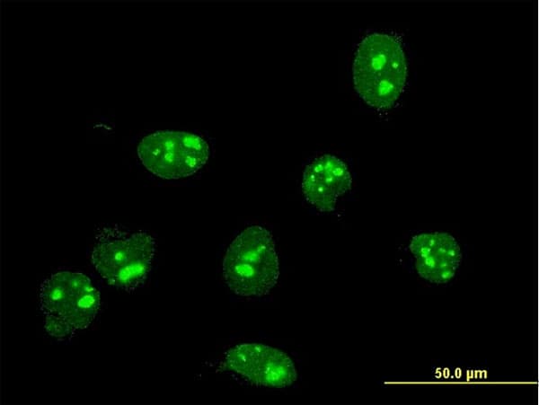 Monoclonal Mouse anti-Human FBL / FIB / Fibrillarin Antibody (clone 4G9-E4, IF, WB)