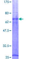 Human SLC14A1 / JK Protein (Recombinant GST)