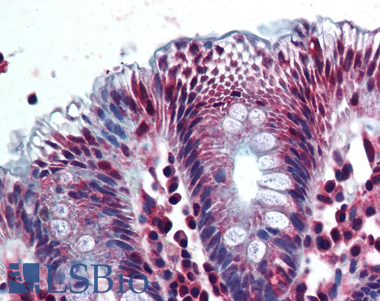 IHC-plus™ Polyclonal Rabbit anti-Human AKR1B10 Antibody (aa100-200, IHC, WB)
