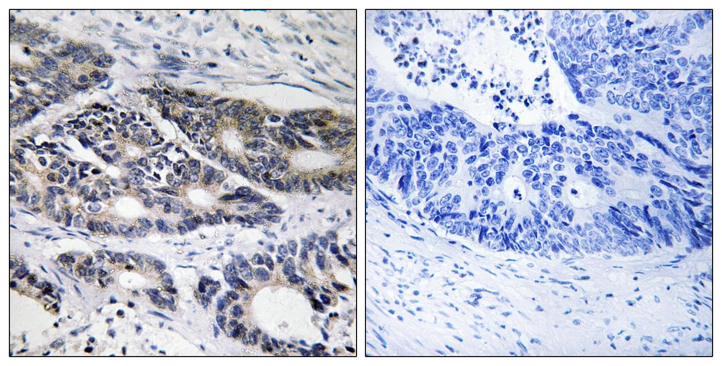 Polyclonal Rabbit anti-Human Cytochrome P450 2R1 / CYP2R1 Antibody (IF, WB)