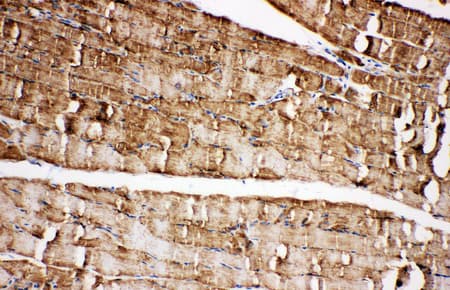 VDAC1 / PORIN Antibody (aa163-178)
