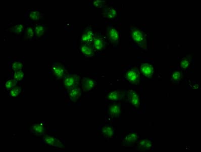 HIST1H2BN Antibody