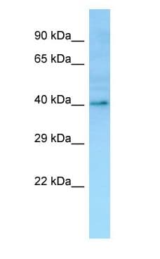 Polyclonal Rabbit anti-Human OR1I1 Antibody (C-Terminus, WB)