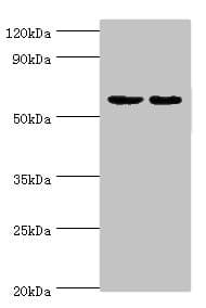 DGKE / DGK Epsilon Antibody (aa40-260)