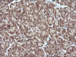 MAP2K3 / MEK3 / MKK3 Antibody (clone OTI6B11, Carrier-free)