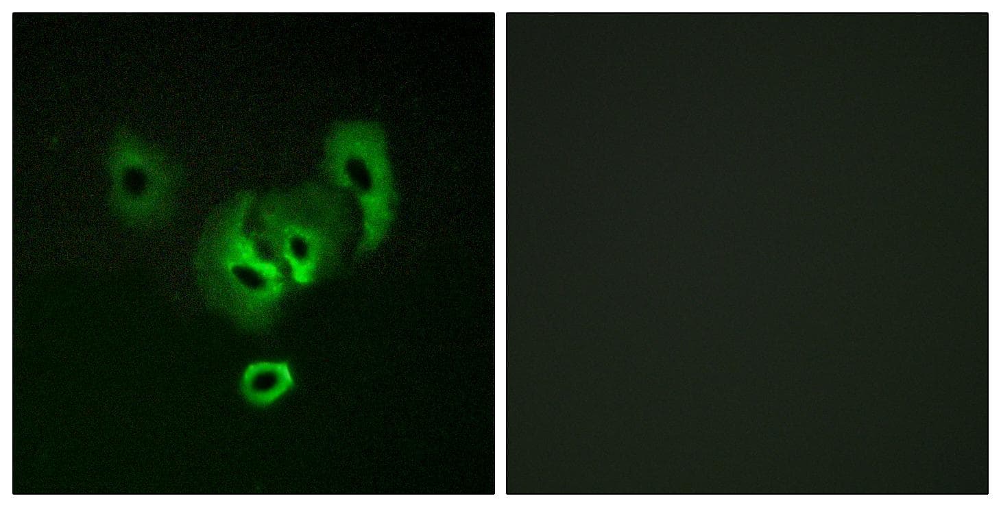 Polyclonal Rabbit anti-Human STEAP2 Antibody (IHC, IF)