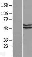 KATNAL2 Protein (Over-Expression Lysate Myc-DDK (Flag))