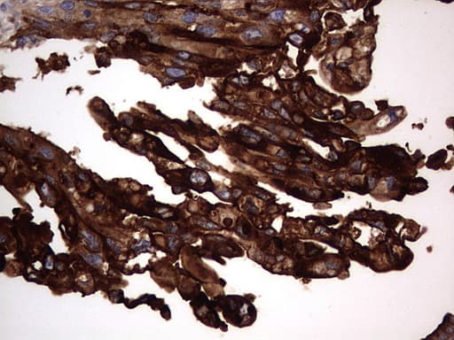 Monoclonal Mouse anti-Human CEACAM5 / CD66e Antibody (clone OTI3D8, aa35-680, IHC, WB)