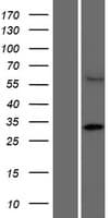 Human CCDC122 Protein (Over-Expression Lysate Myc-DDK (Flag))