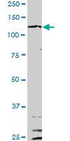 IL6ST / CD130 / gp130 Antibody (clone 4A4)