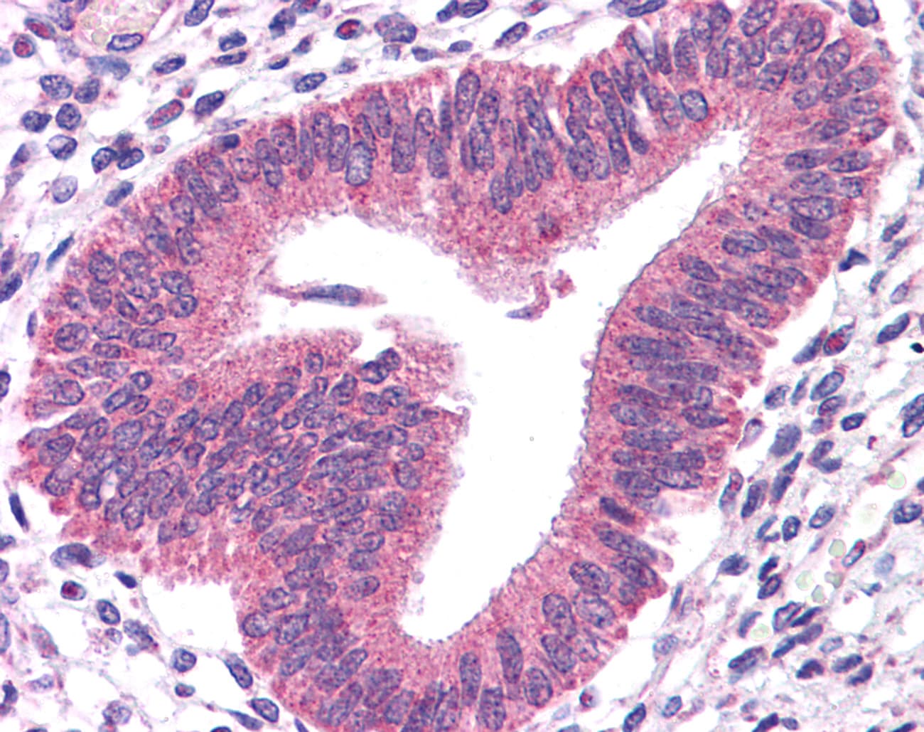 STAT3 Antibody (N-Terminus)