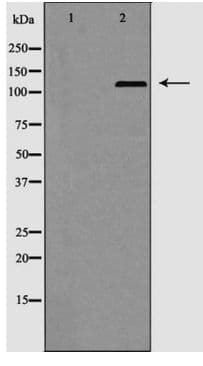 NOS2 / iNOS Antibody