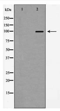 Actinin-Alpha 2+3 Antibody