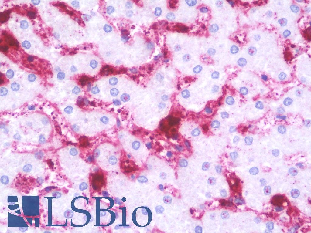 IHC-plus™ NDUFV2 Antibody (aa20-69)