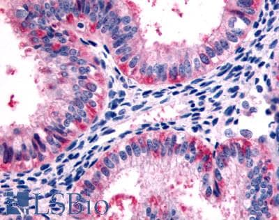 IHC-plus™ Polyclonal Rabbit anti-Human HTR2C / 5-HT2C Receptor Antibody (Cytoplasmic Domain, IHC)