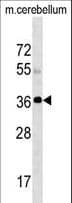 IHC-plus™ Polyclonal Rabbit anti-Human SLC25A20 / CACT Antibody (aa235-264, IHC, WB)