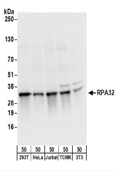 IHC-plus™ Polyclonal Rabbit anti-Human RPA2 / RFA2 / RPA34 Antibody (aa225-C-term, IHC, WB)